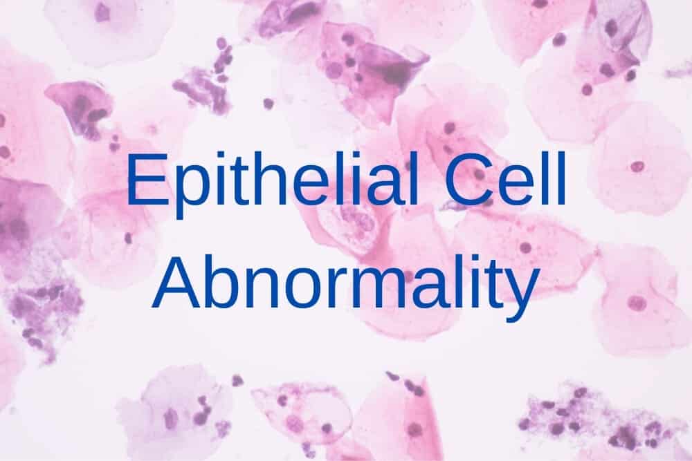 Epithelial Cell Abnormality