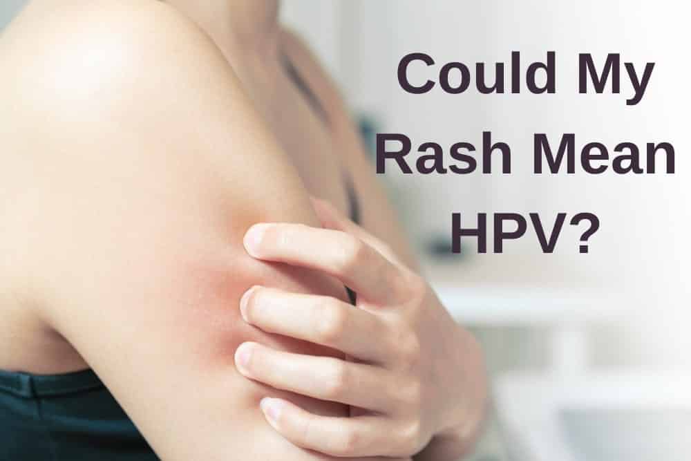 Does Hpv Cause Frequent Yeast Infections